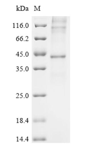 Observed band size: 44&110&130 kDa. It is speculated that the protein forms a multimer structure.<br />M: Protein ladder